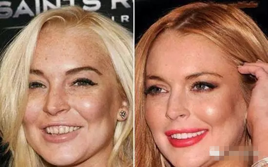 廣州國(guó)際美博會(huì)，相約薇絲頓牙齒美白納米齒雕(圖6)